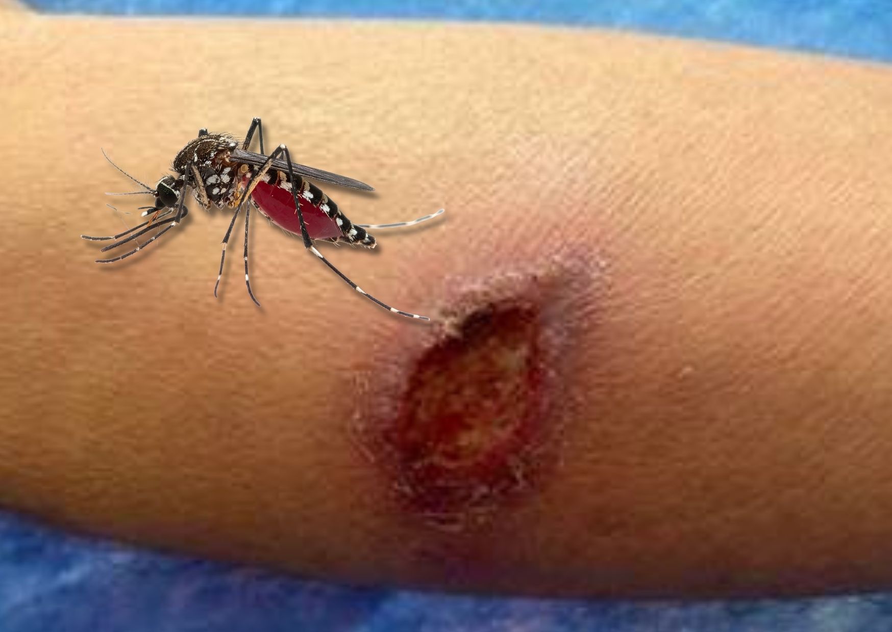 Persona con ropa de manga larga caminando en una zona selvática de Quintana Roo, como medida de prevención ante insectos transmisores de leishmaniasis cutánea.